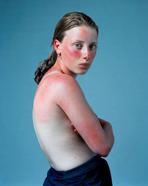 Image from Sunburnt, 2001 by Hendrik Kerstens